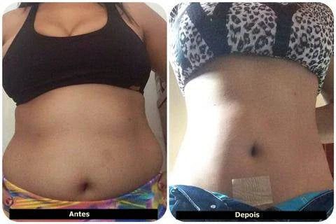 Adesivo Detox Slim Patch Perda de Gordura Localizada - Neoshop